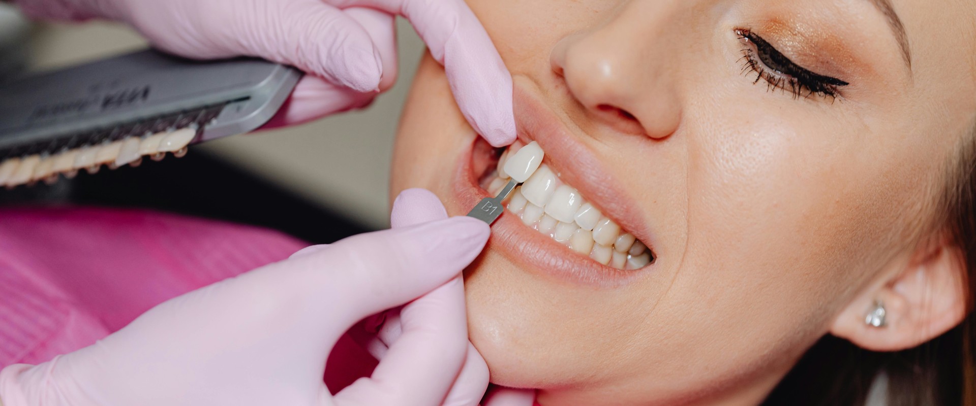 Achieving Total Facial Harmony: The Perfect Blend Of Veneer Dentistry And Aesthetic Surgery In McGregor, TX