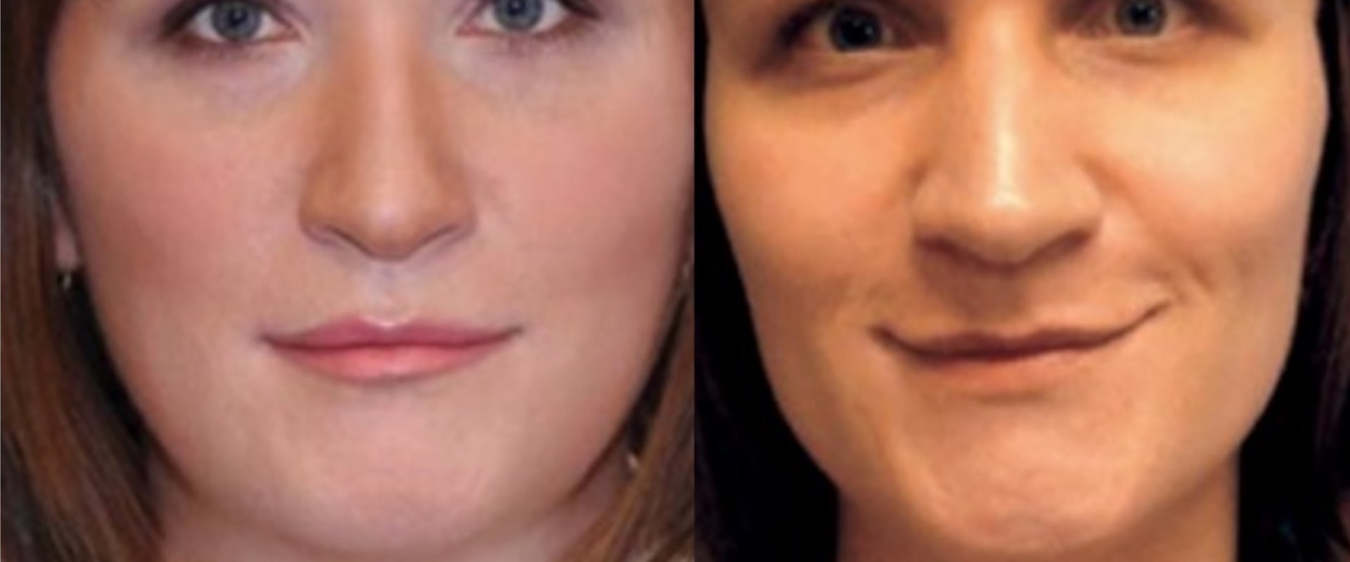 The Benefits of Aesthetic Surgery: Enhancing Your Appearance and Self-Esteem
