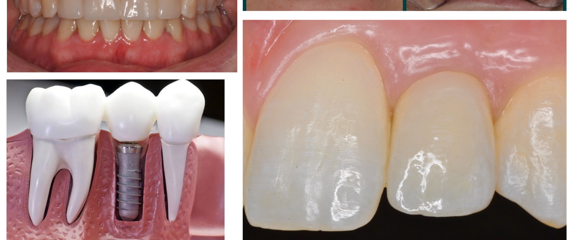 Emergency Dentist Services And Aesthetic Surgery For A Complete Smile Makeover In Pflugerville