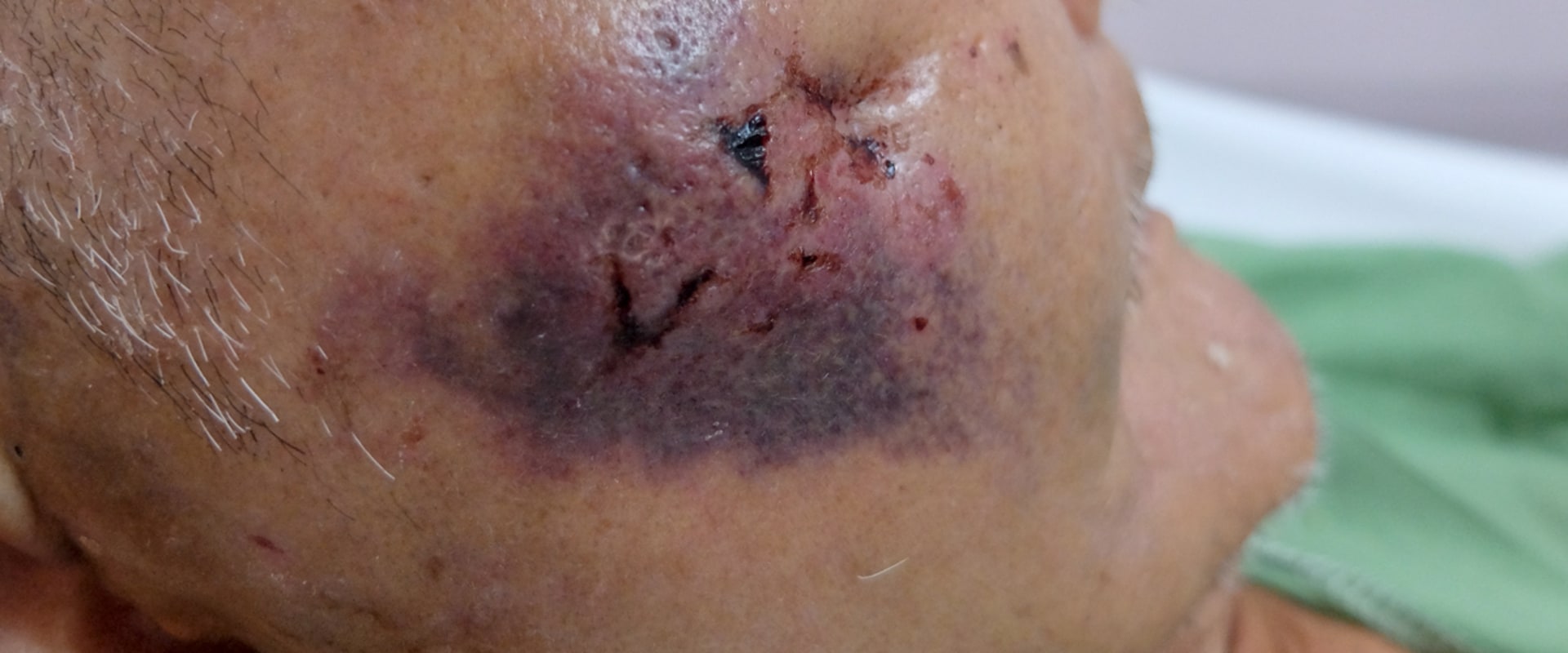 What Are the Health Risks of Aesthetic Surgery?