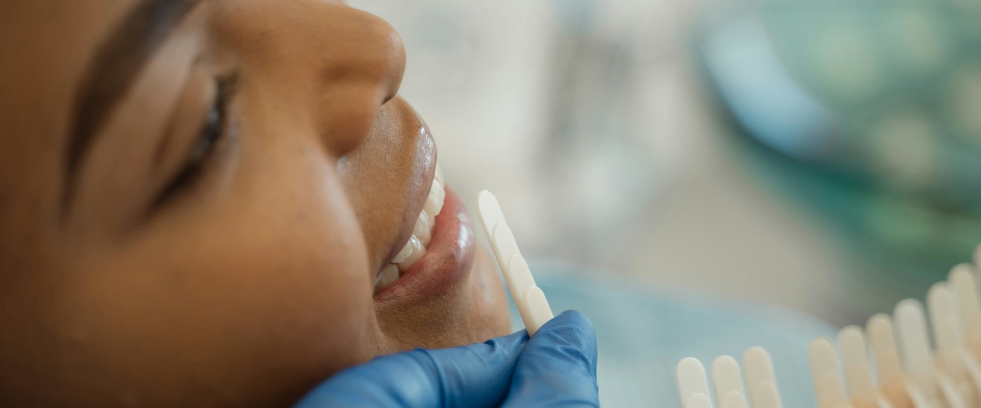 Enhancing Beauty, One Tooth At A Time: Dental Bonding In Round Rock's Aesthetic Surgery Scene