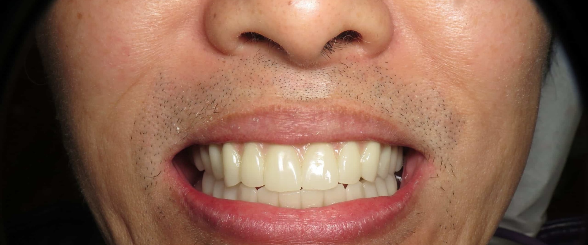 Say Goodbye To Imperfections: How Aesthetic Surgery Can Reshape Your Dental Journey In San Antonio, TX