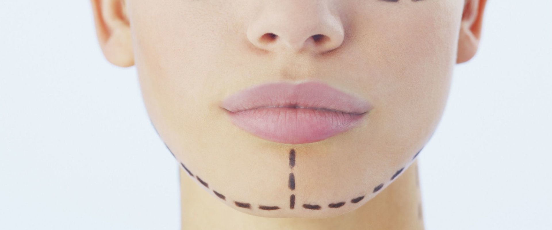 What Should I Consider Before Getting Aesthetic Surgery?