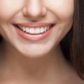 Achieve A Stunning Smile In San Antonio: The Best Dentistry And Aesthetic Surgery Options