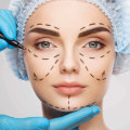 Who is Not a Good Candidate for Plastic Surgery?