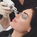 Non-Surgical Alternatives to Aesthetic Surgery