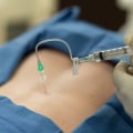 Pain-Free Living With Pain Management Therapeutic Procedures In The Cayman Islands, Including Aesthetic Surgery