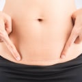 Do Plastic Surgery Scars Fade Away?