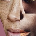 What is the Most Legitimate Accreditation for Plastic Surgery?