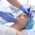 Preparing for Aesthetic Surgery: What You Need to Know