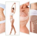 Types of Aesthetic Surgery: What You Need to Know