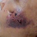 The Risks and Benefits of Aesthetic Surgery