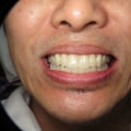 Say Goodbye To Imperfections: How Aesthetic Surgery Can Reshape Your Dental Journey In San Antonio, TX