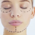 What Should I Consider Before Getting Aesthetic Surgery?