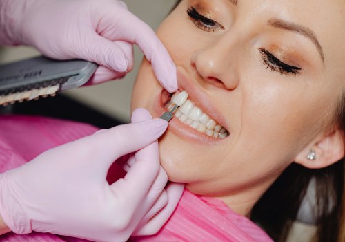 Achieving Total Facial Harmony: The Perfect Blend Of Veneer Dentistry And Aesthetic Surgery In McGregor, TX