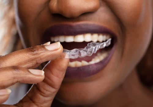 How Spark Aligners Can Complement And Enhance The Results Of Aesthetic Surgery In London