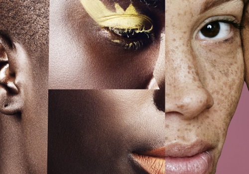 Special Considerations for People with Darker Skin Tones Considering Aesthetic Surgery