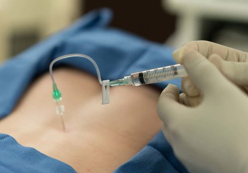 Pain-Free Living With Pain Management Therapeutic Procedures In The Cayman Islands, Including Aesthetic Surgery
