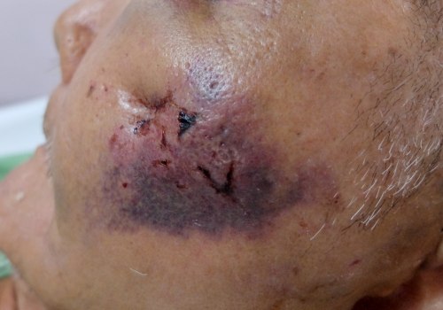 What Are the Health Risks of Aesthetic Surgery?