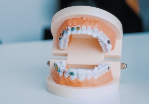 The Power Of Aesthetic Surgery In Achieving Your Dream Smile And Optimal Dental Health In Austin