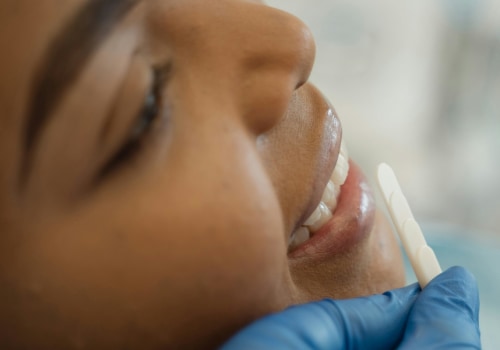 Enhancing Beauty, One Tooth At A Time: Dental Bonding In Round Rock's Aesthetic Surgery Scene
