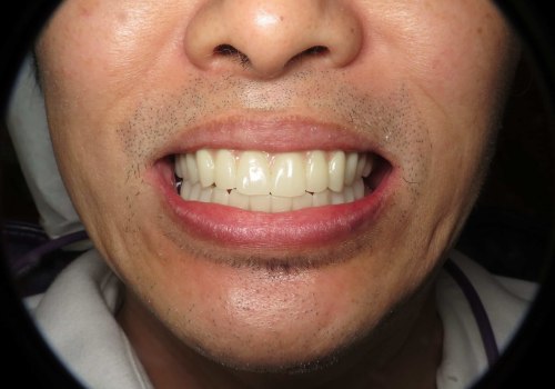 Say Goodbye To Imperfections: How Aesthetic Surgery Can Reshape Your Dental Journey In San Antonio, TX
