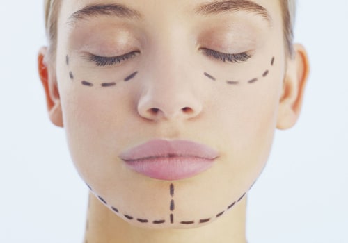 What Should I Consider Before Getting Aesthetic Surgery?